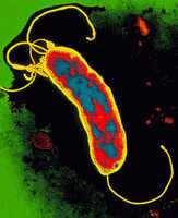 h. pylori baktériumok és fogyás